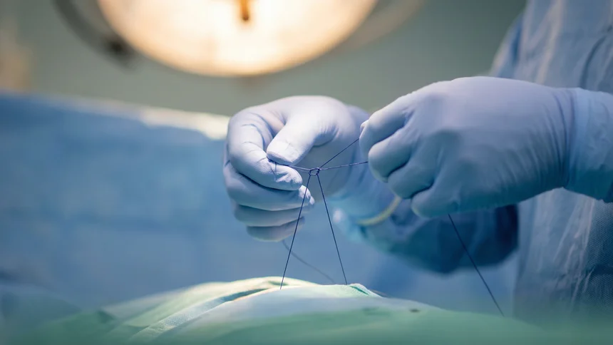 Gloved hands tying surgical knot with suture